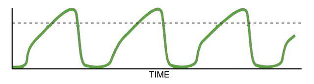 Obstructive Disease Waveform