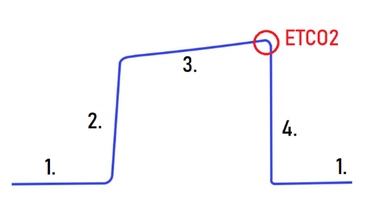 Normal Waveform and Phases